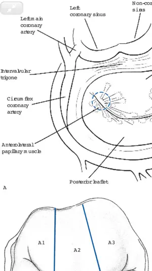 Cardiac Surgery in Adults, 5/E